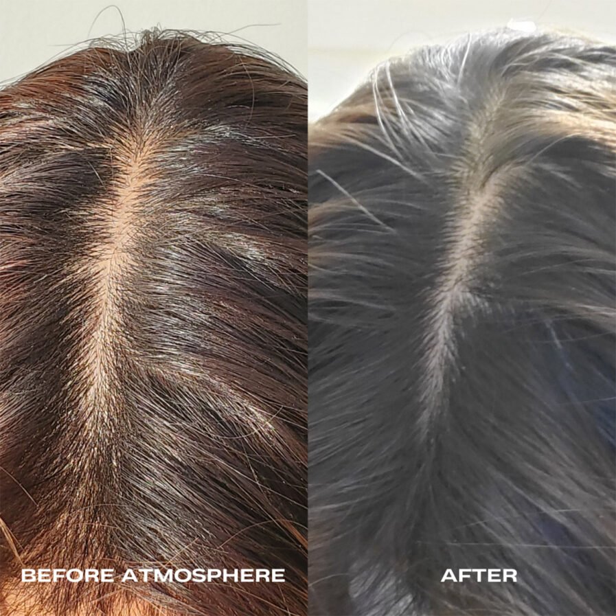 Luna Nectar Atmosphere Hair Density Scalp Serum Before and After.