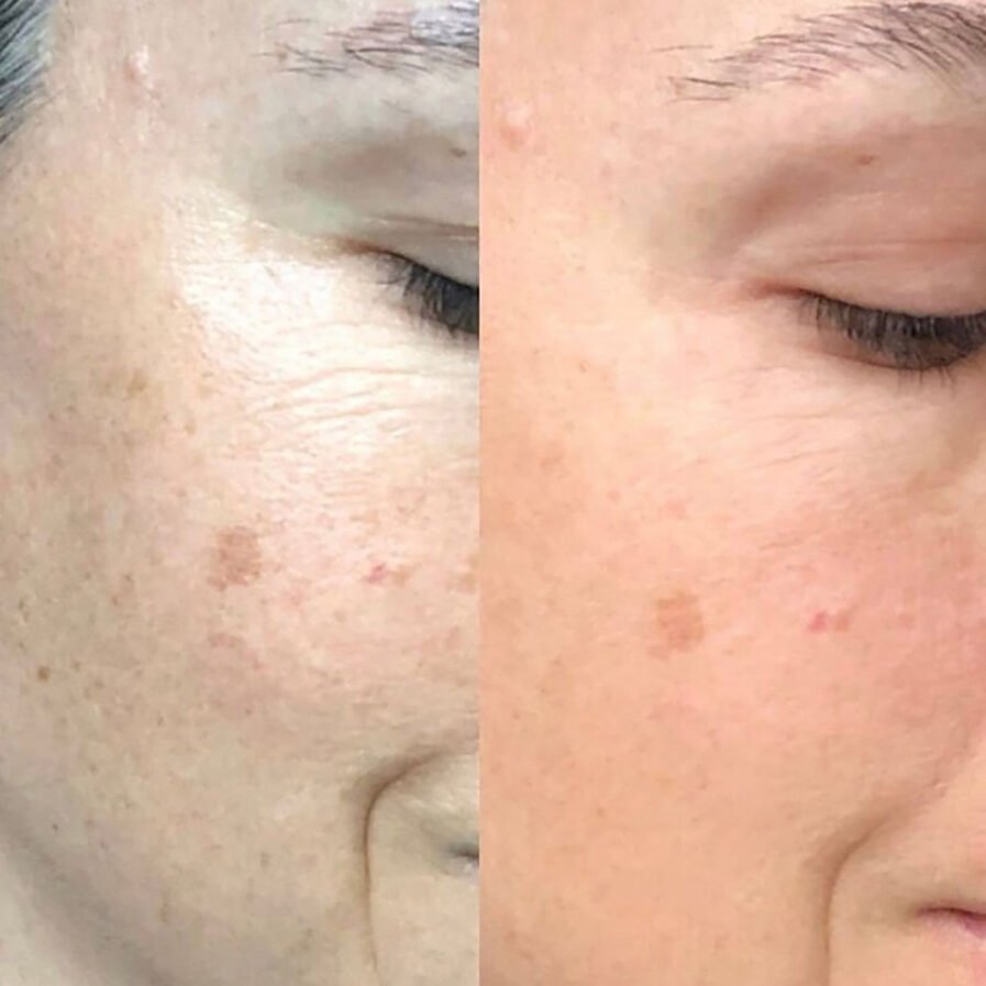 Maya Chia The Straight A Advanced Gentle Retinol Treatment helps smooth fines lines, wrinkles and texture, and fade the appearance of dark spots.